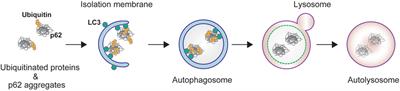 Activation of p62/SQSTM1–Keap1–Nuclear Factor Erythroid 2-Related Factor 2 Pathway in Cancer